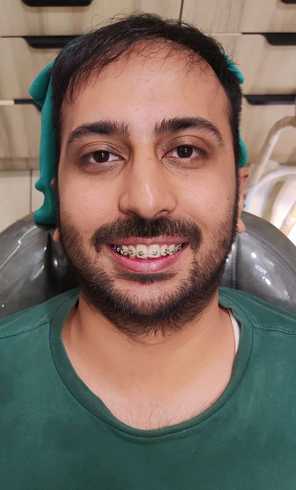 Patient Smile #13