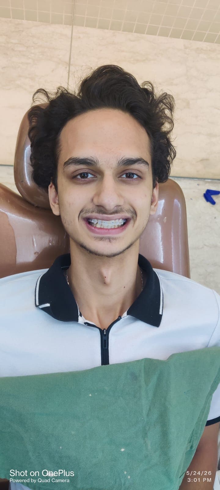 Patient Smile #24