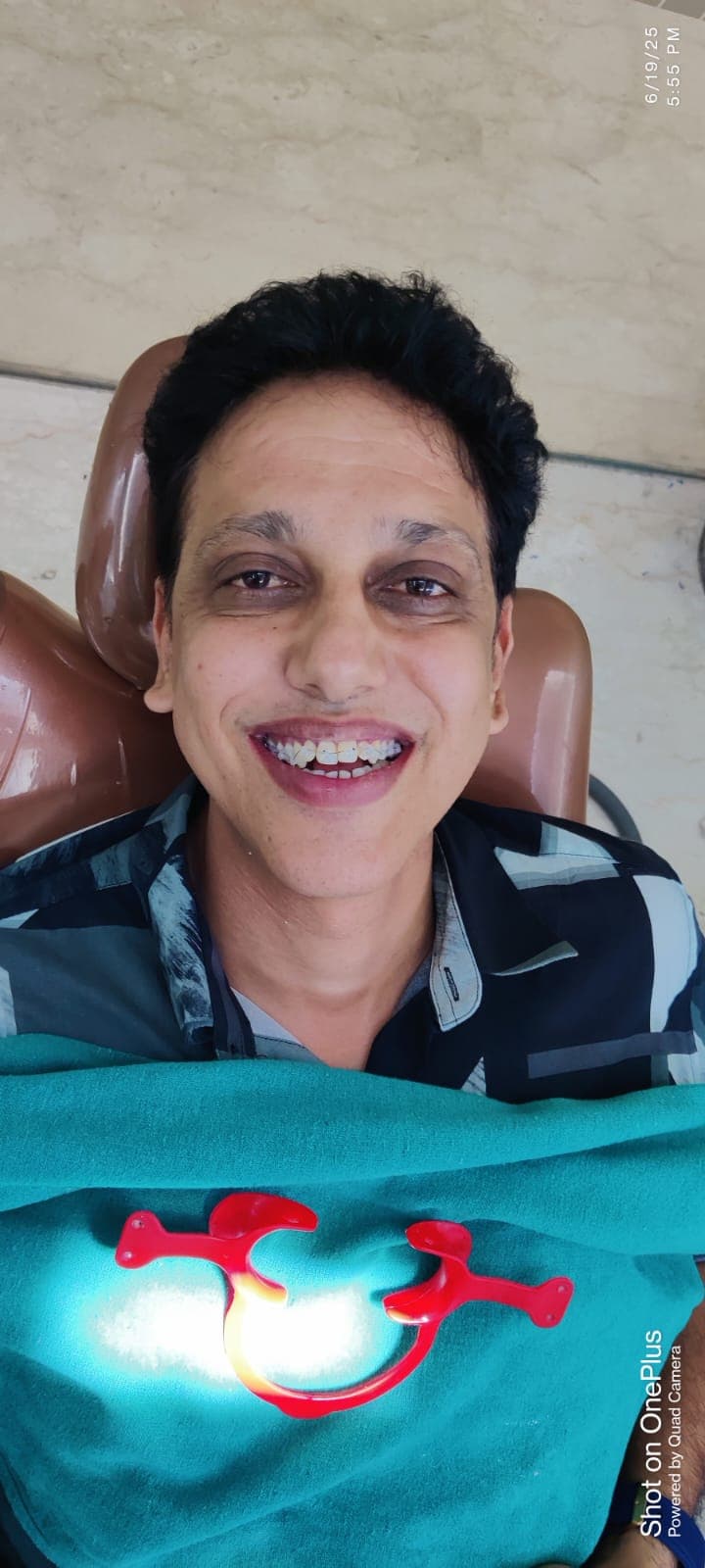Patient Smile #30
