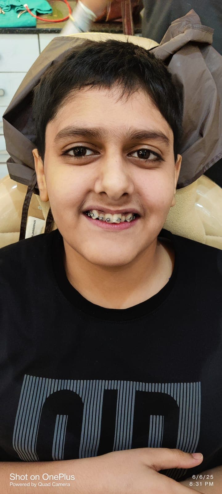 Patient Smile #32