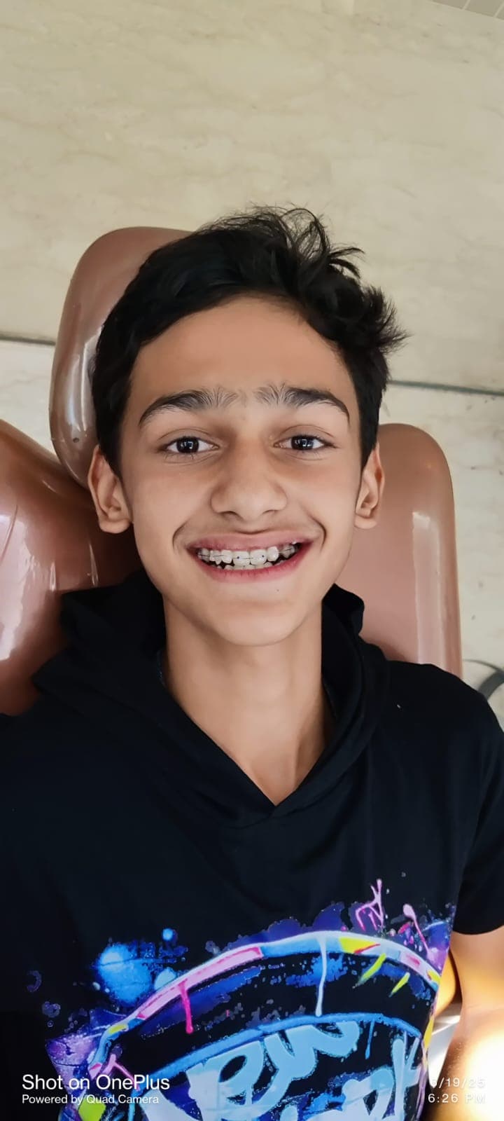 Patient Smile #33