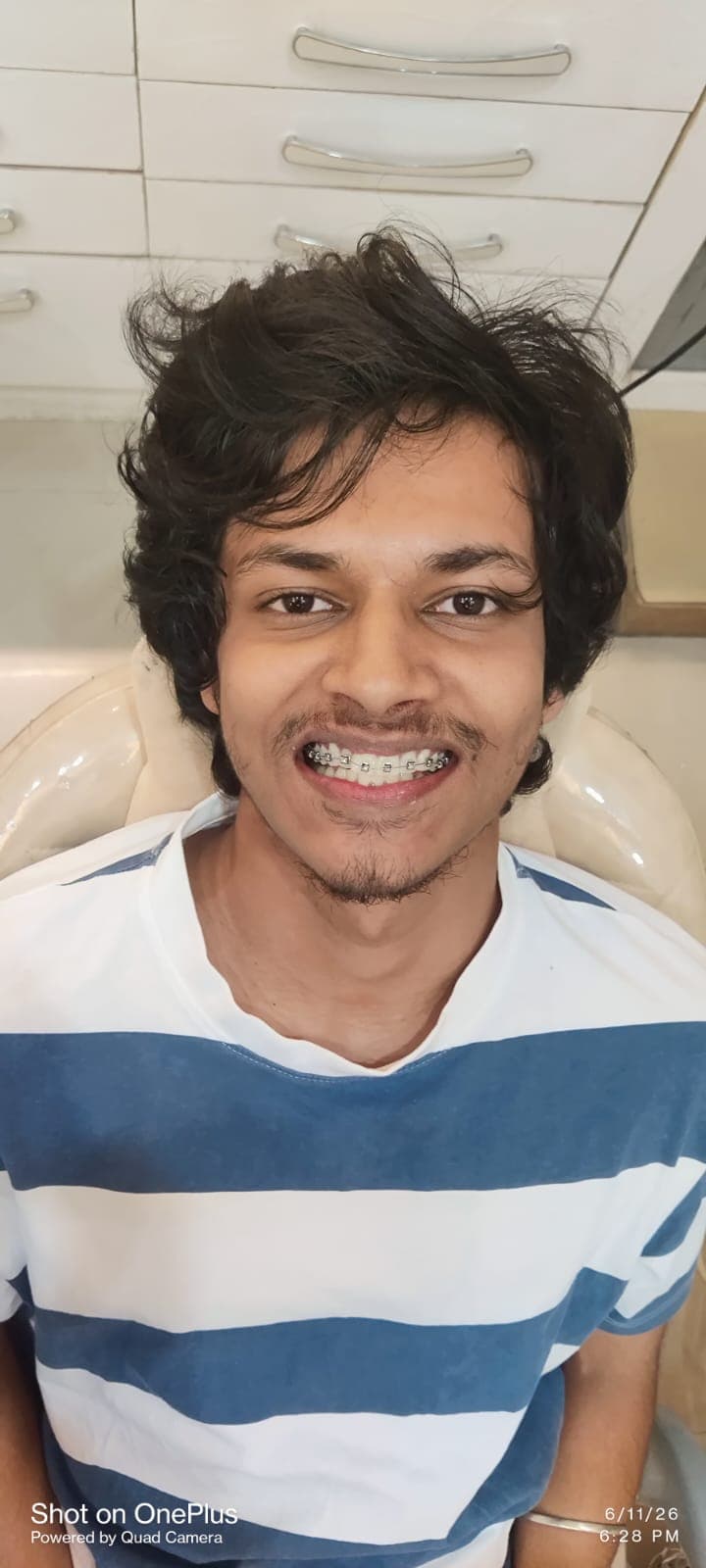 Patient Smile #38