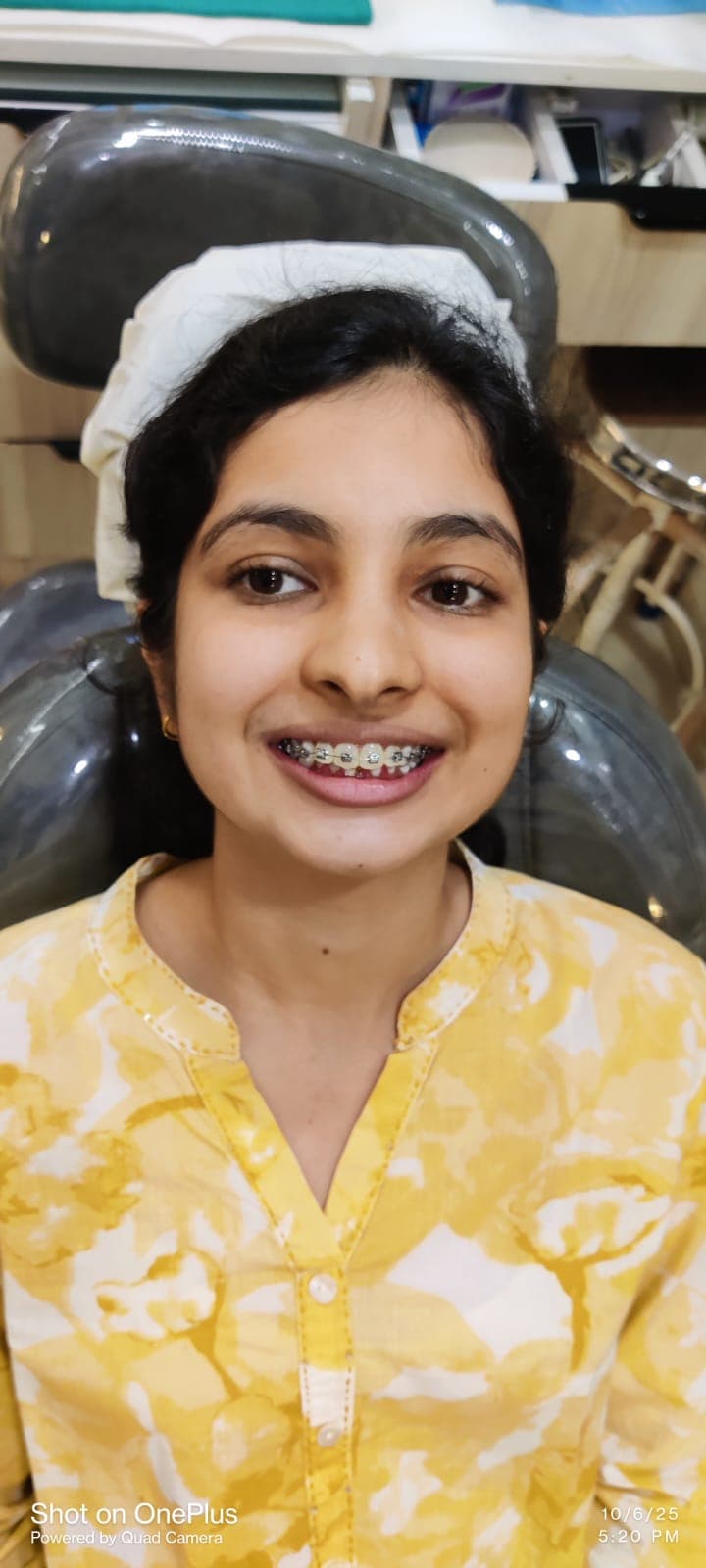 Patient Smile #39