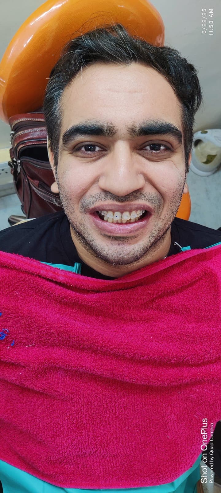 Patient Smile #40