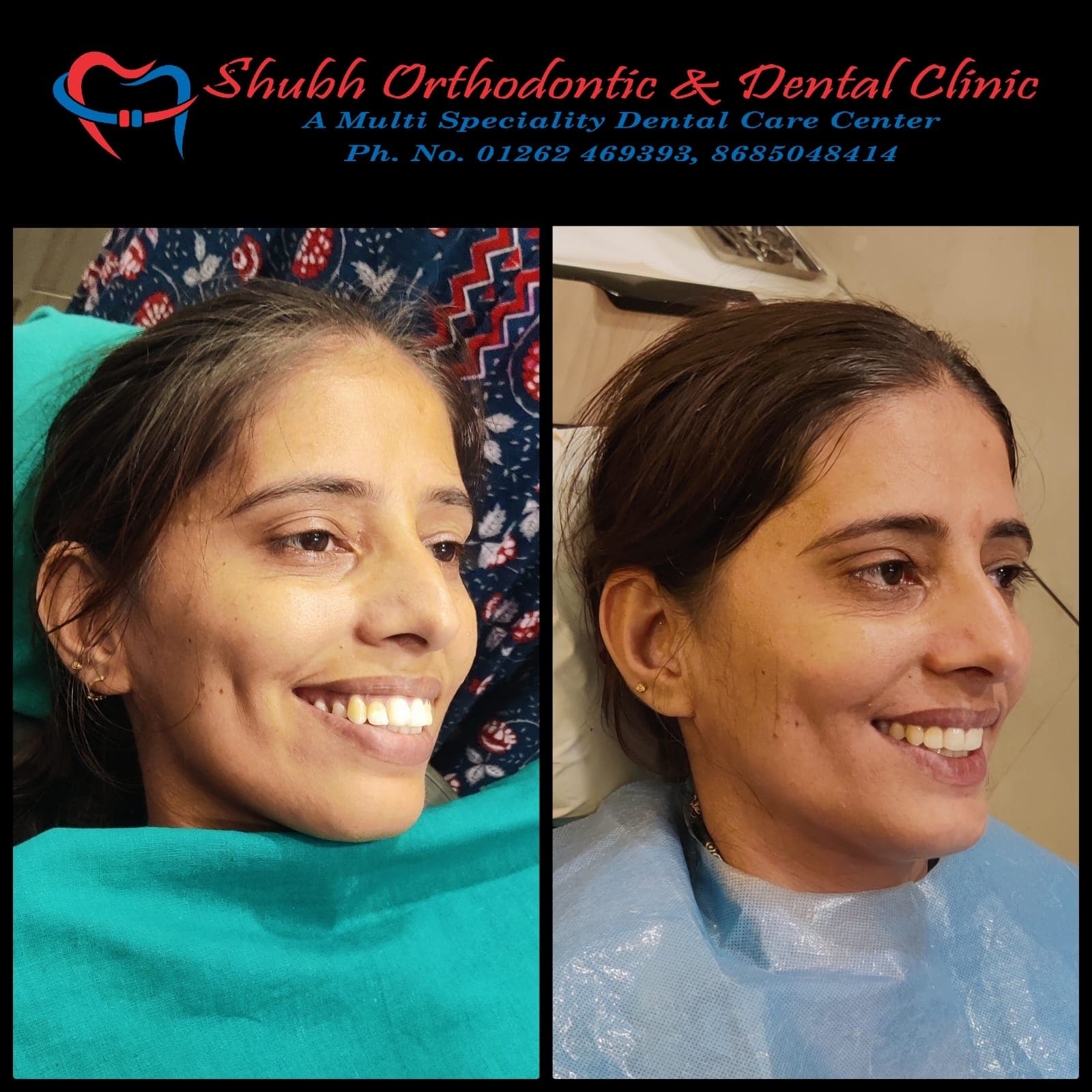 Smile Transformation #13