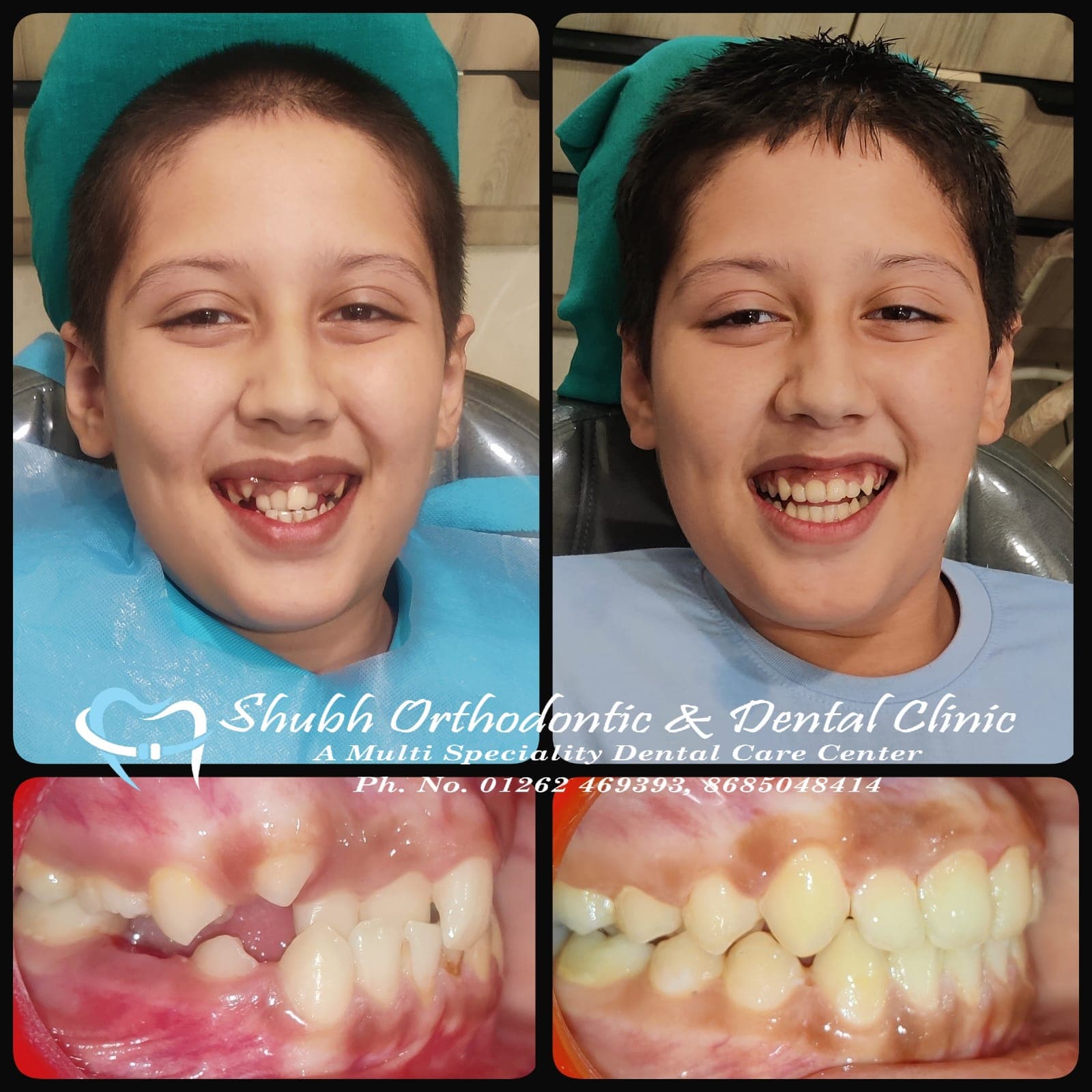 Smile Transformation #14