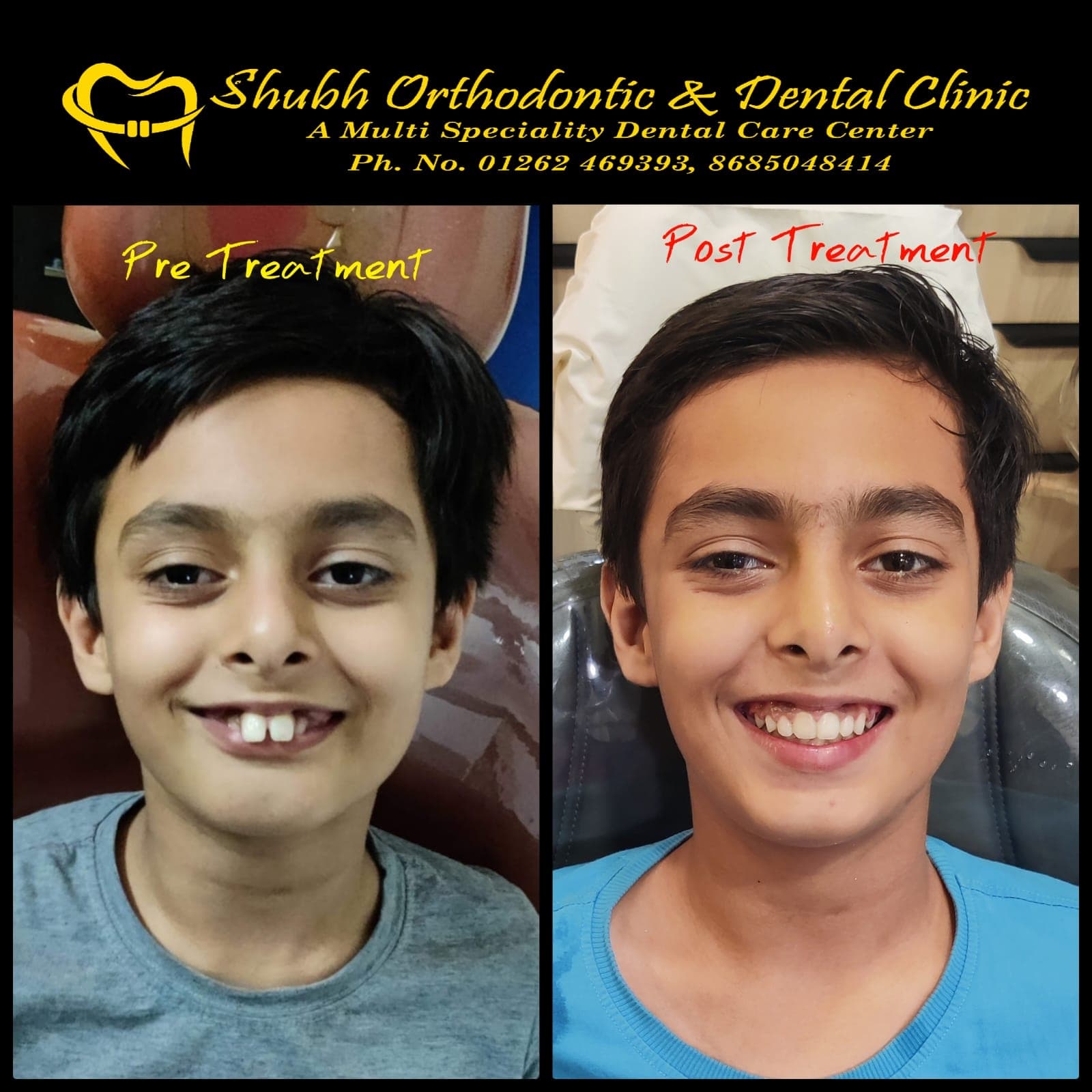 Smile Transformation #18