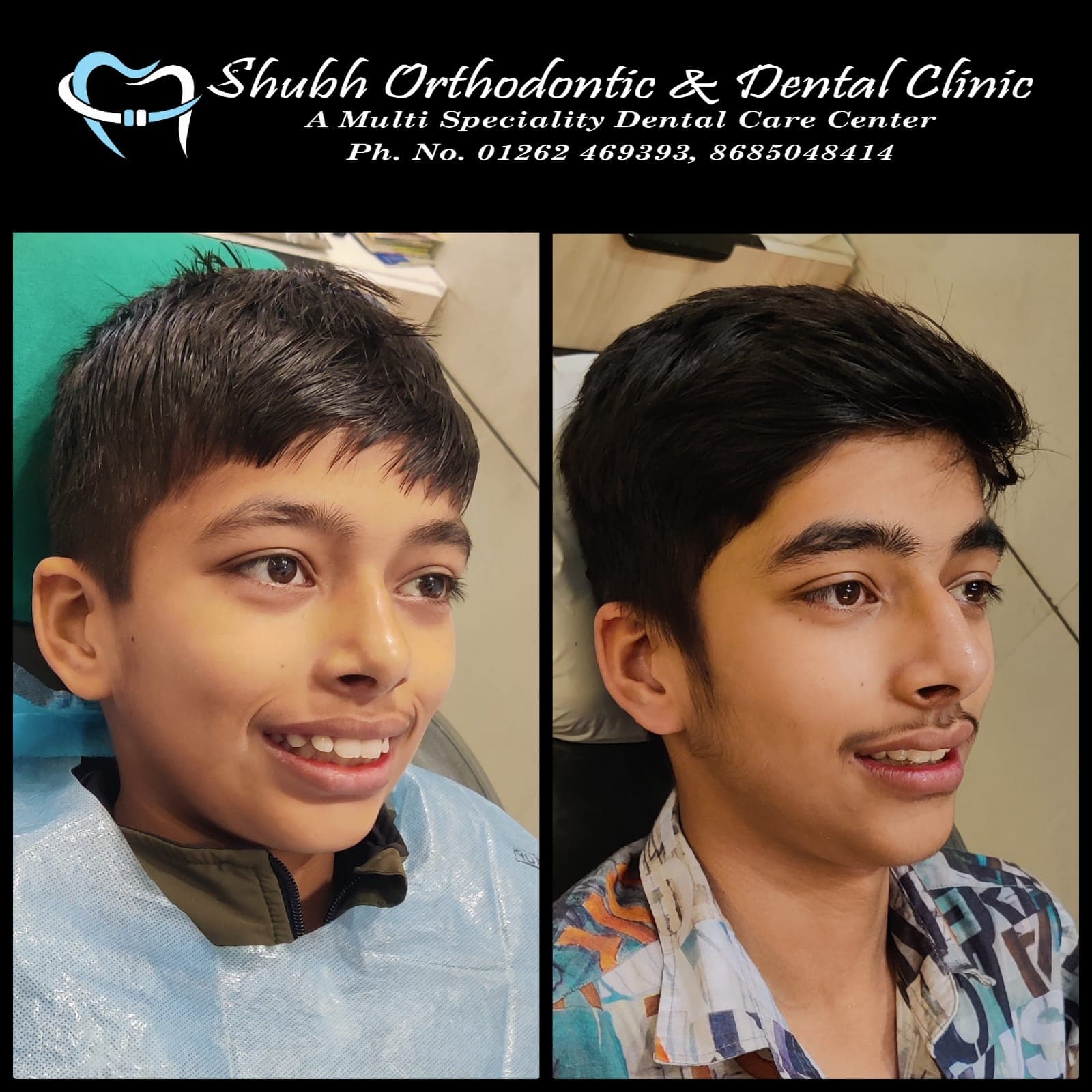 Smile Transformation #22