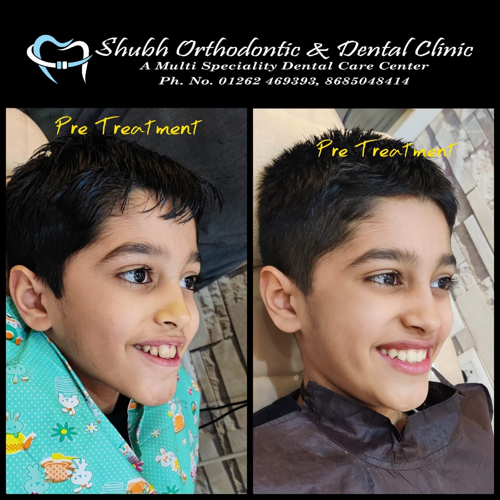 Smile Transformation #23