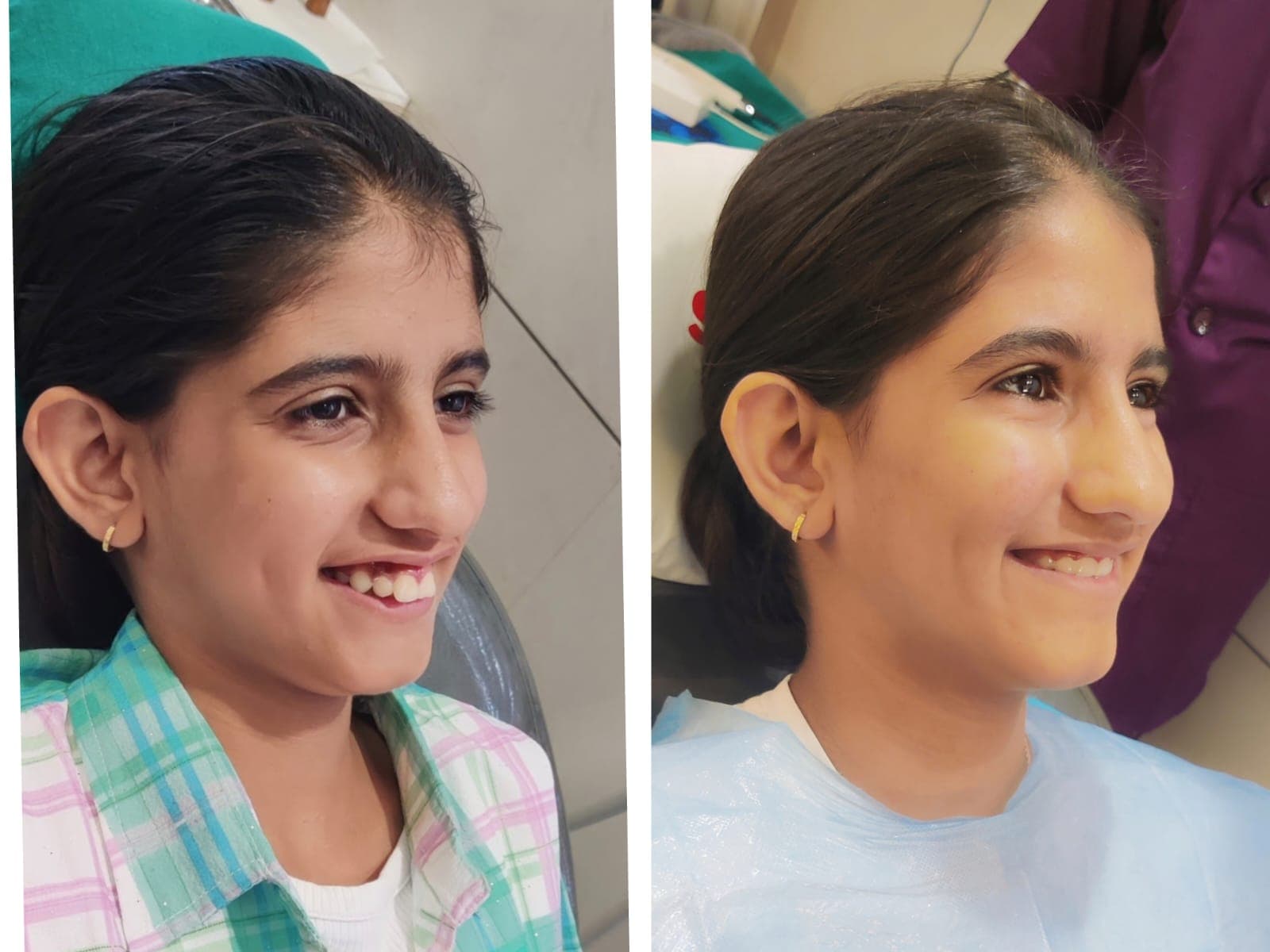Smile Transformation #27