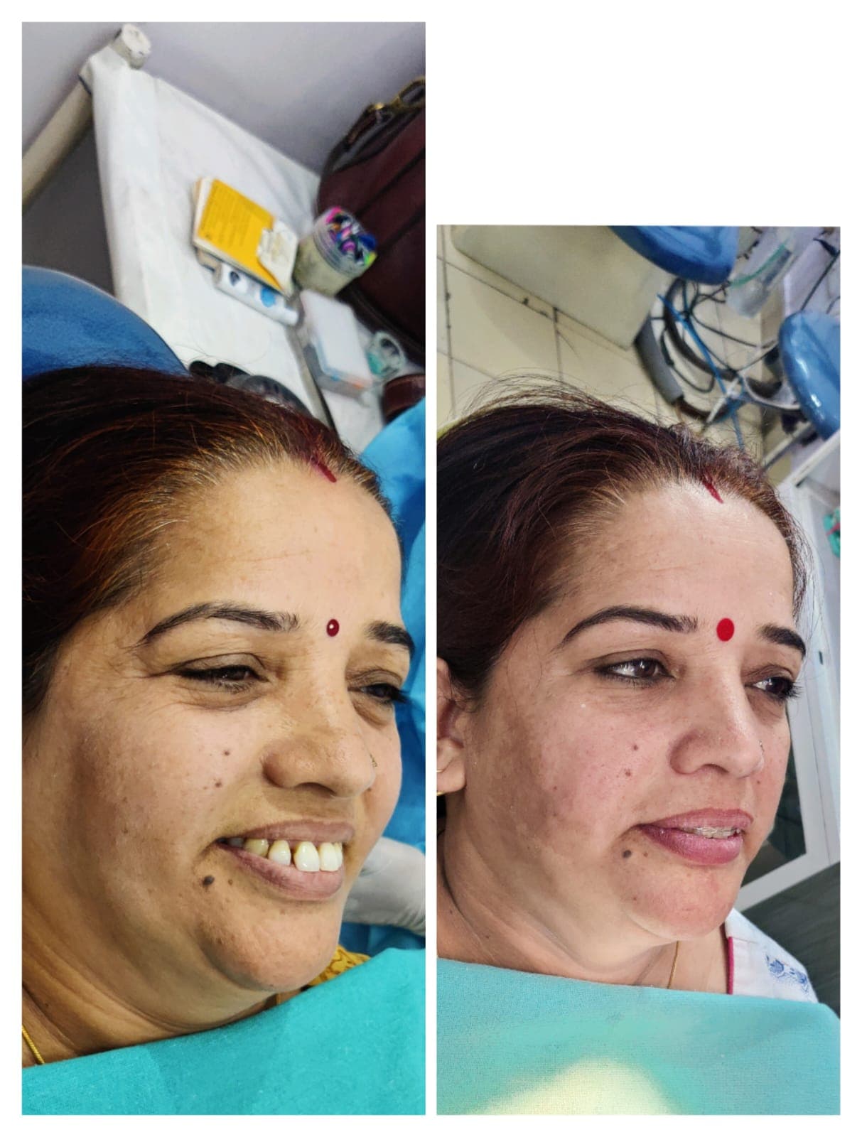 Smile Transformation #31